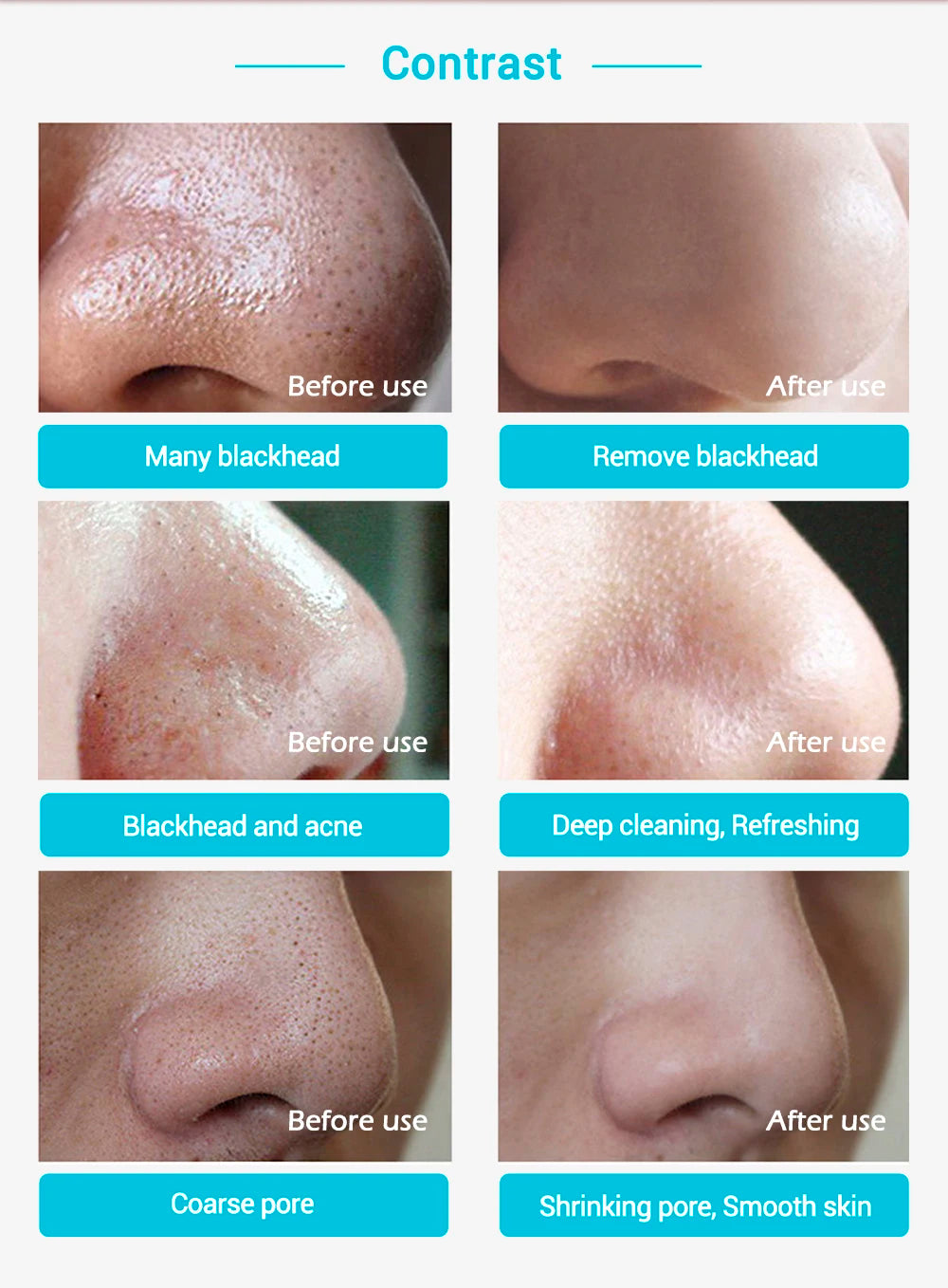 LANBENA Neue Stil Mitesser Entferner Nase Maske Poren Streifen Schwarze Maske Peeling Schwarz Tiefen Reinigung Hautpflege Schönheit Gesundheit