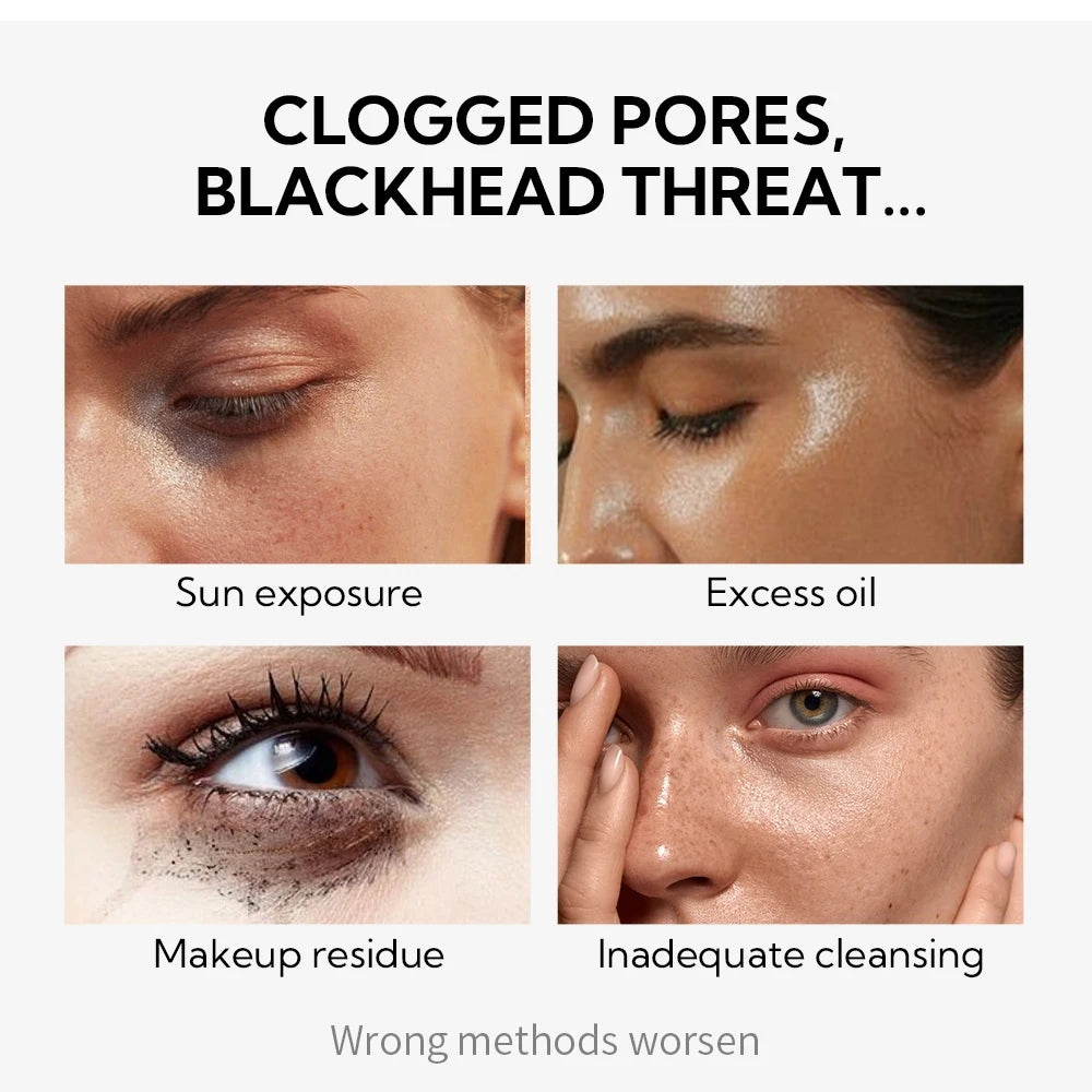 LANBENA Neue Stil Mitesser Entferner Nase Maske Poren Streifen Schwarze Maske Peeling Schwarz Tiefen Reinigung Hautpflege Schönheit Gesundheit