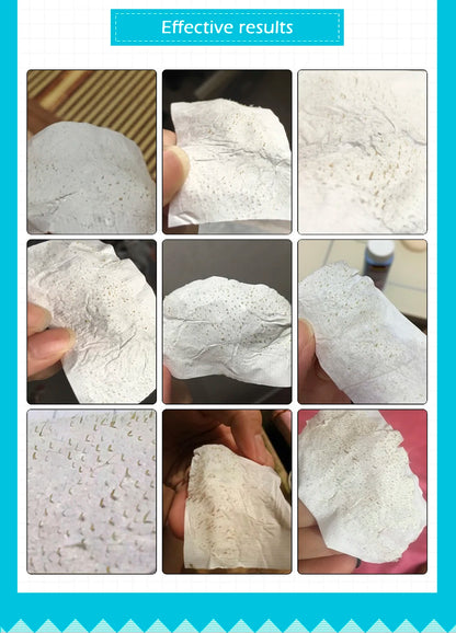 LANBENA Neue Stil Mitesser Entferner Nase Maske Poren Streifen Schwarze Maske Peeling Schwarz Tiefen Reinigung Hautpflege Schönheit Gesundheit