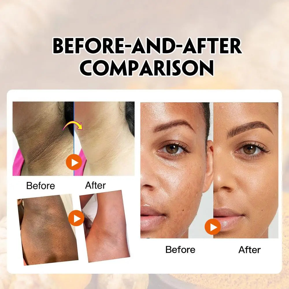 Kurkuma-Peeling, 150 g, hautaufhellendes Peeling, Gesichts- und Körperpeeling, entfernt abgestorbene Haut, tief reinigendes Bikini-Peeling für dunkle Innenseite