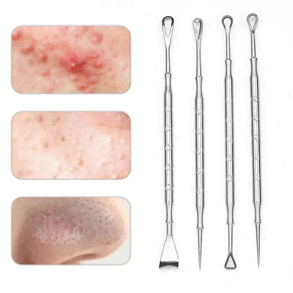 1-5pc Mitesser Entferner Pickel Popper Werkzeug Akne Nadel Entfernen Behandlung Whitehead Popping Zit Nase Gesicht Makel extractor-Tool