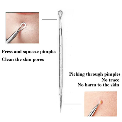 1-5pc Mitesser Entferner Pickel Popper Werkzeug Akne Nadel Entfernen Behandlung Whitehead Popping Zit Nase Gesicht Makel extractor-Tool