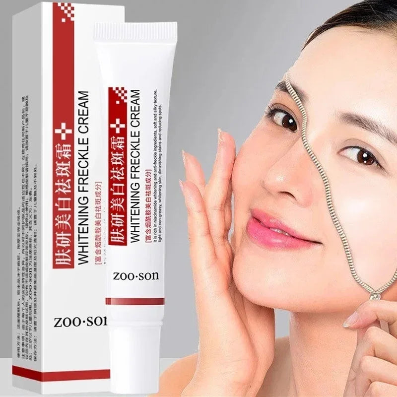 Aufhellende Sommersprossencreme, Niacinamid, entfernt dunkle Flecken, verblasst Pigmentierung, Melasma, verbessert Stumpfheit, schnelles Aufhellen, nährt die Hautpflege