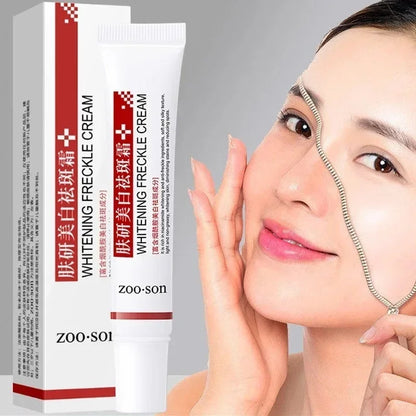 Aufhellende Sommersprossencreme, Niacinamid, entfernt dunkle Flecken, verblasst Pigmentierung, Melasma, verbessert Stumpfheit, schnelles Aufhellen, nährt die Hautpflege