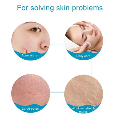 Derma Roller Micro Needle 540 ist ein Gesichtspflege- und Schönheitsgerät, das zum Reduzieren von Falten verwendet wird, Narben entfernen, Haut aufhellen und straffen